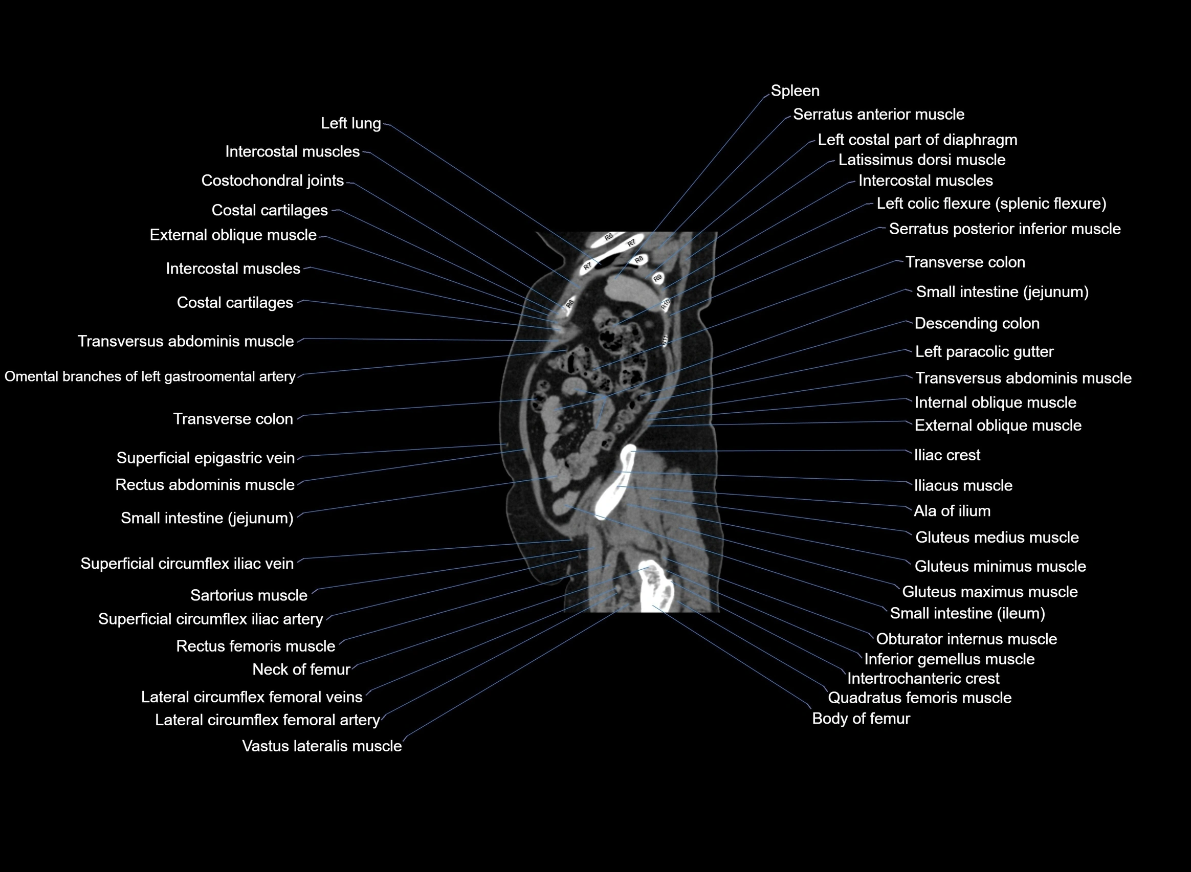 CT Abdomen sagittal cross sectional anatomy labelled radiology image -00020.webp